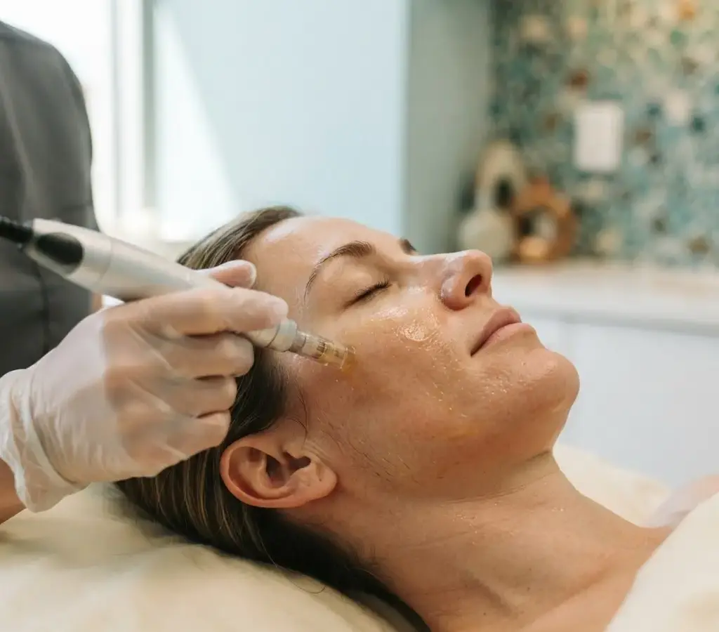 Microneedling with PRP being performed in the Arlington Heights treatment room