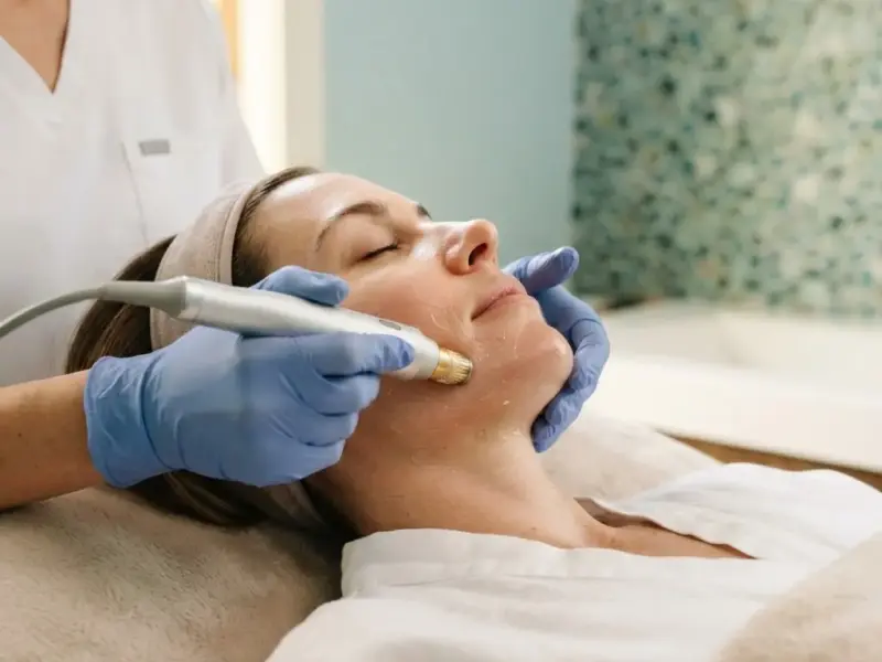 Morpheus8 being performed in the Arlington Heights treatment room